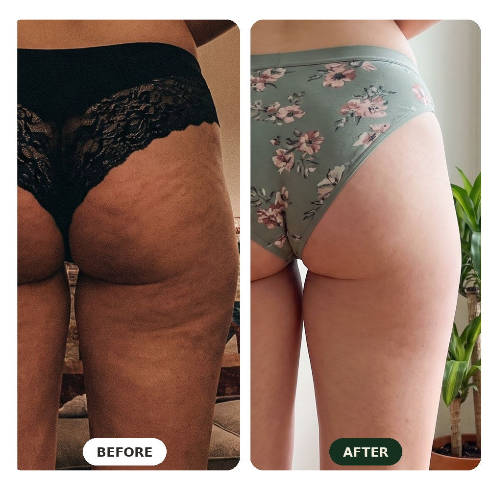 Before and after comparison, thighs