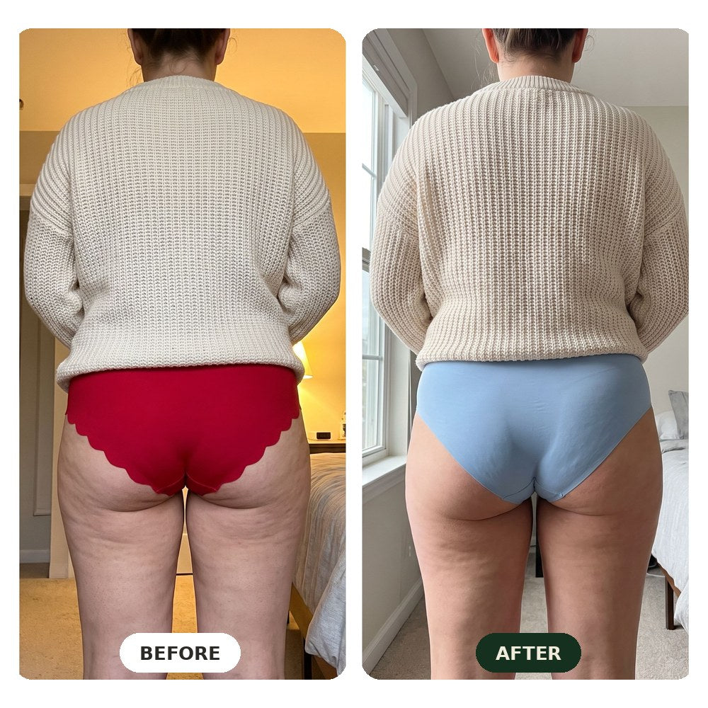 Before and after comparison, back of thighs
