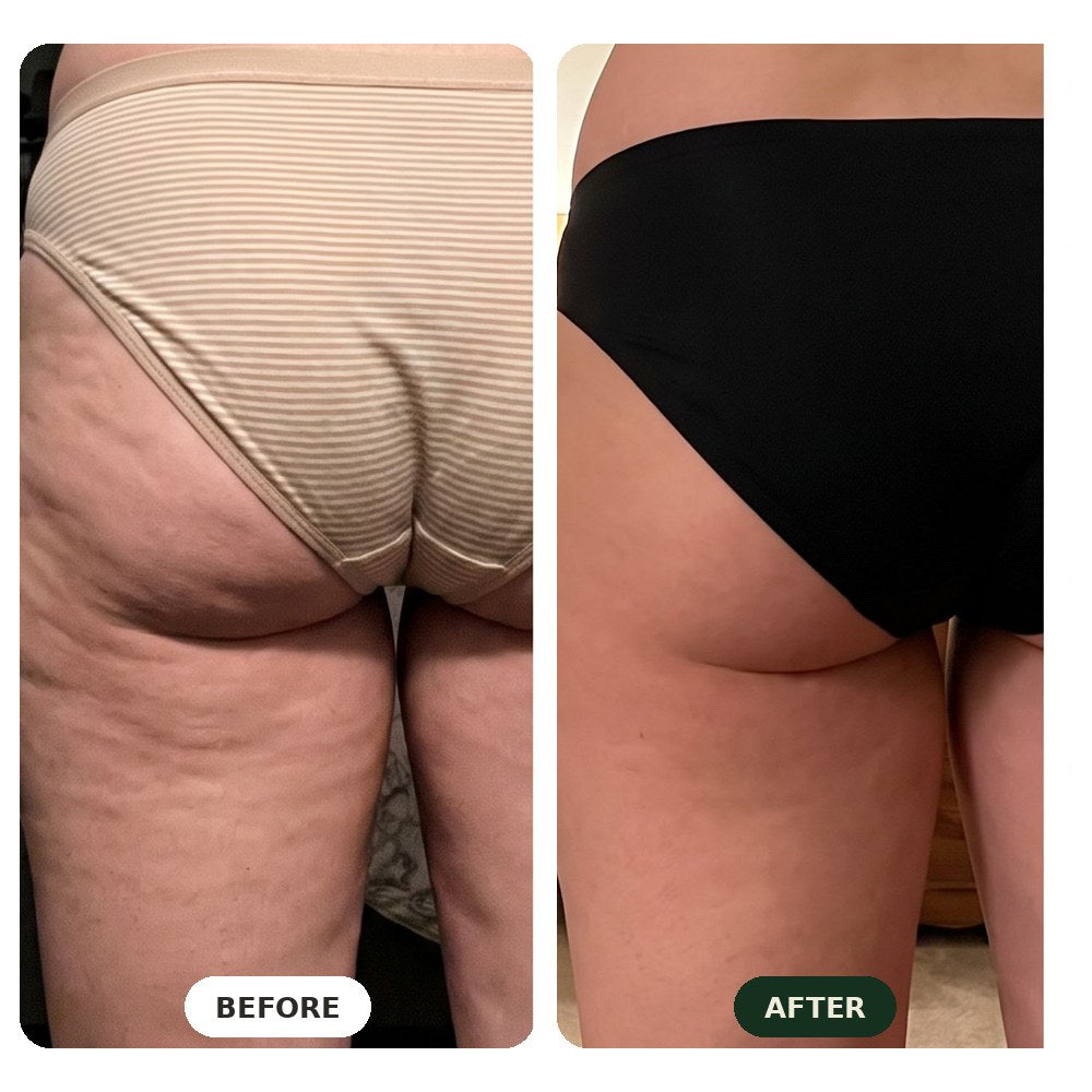 Before and after comparison