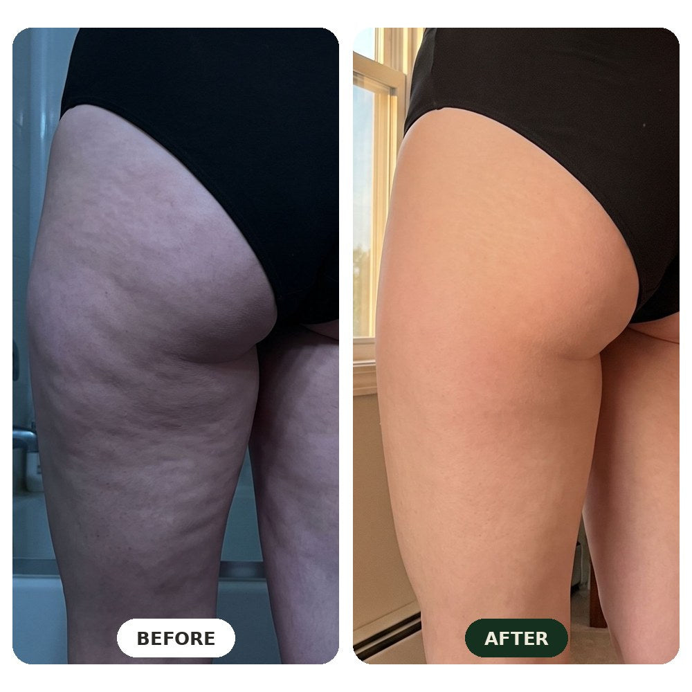 Before and after comparison, thighs in different light